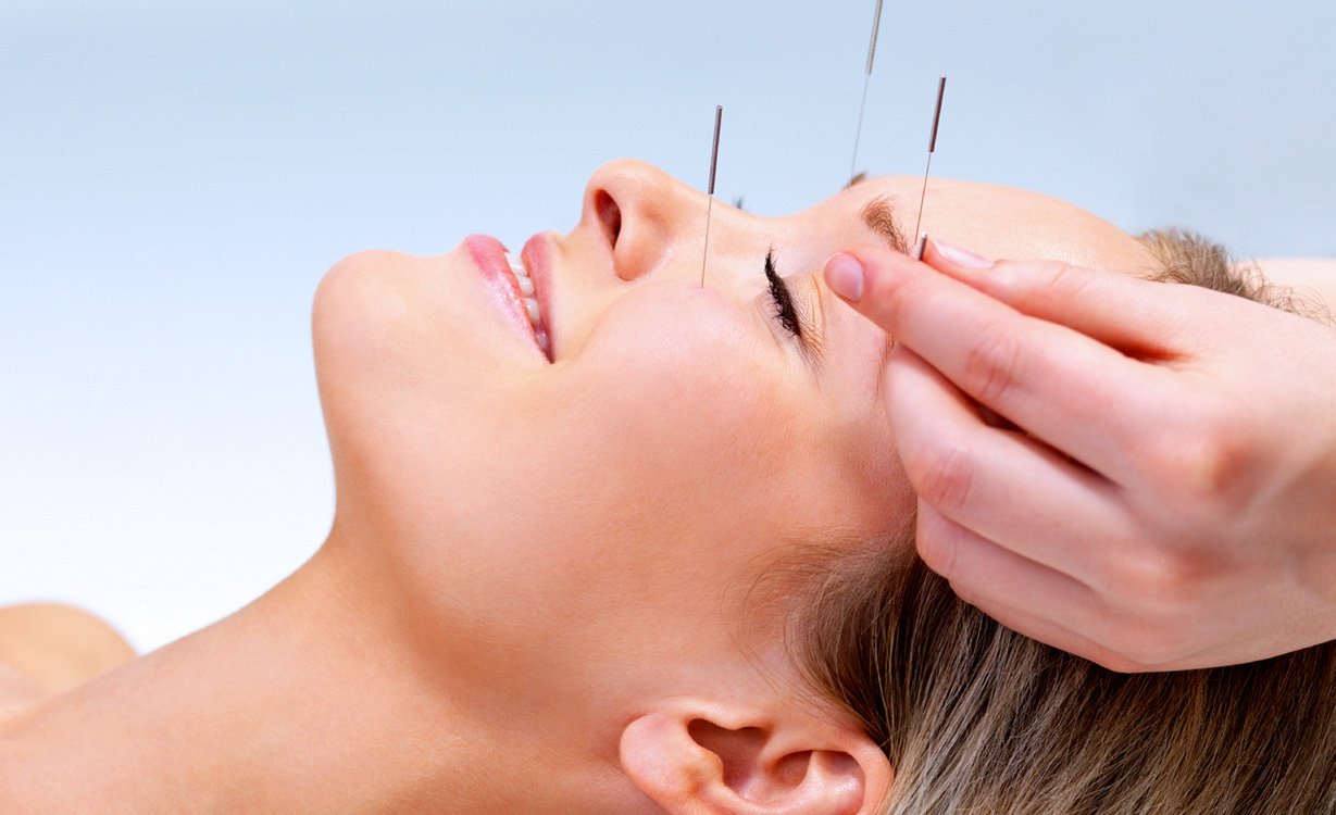 Acupuncture treatment for pain management at Angel Holistic Acupuncture in Fairfax, VA